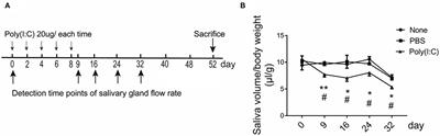 Intratracheal Poly(I:C) Exposure Accelerates the Immunological Disorder of Salivary Glands in Sjogren's-Like NOD/ShiLtJ Mice